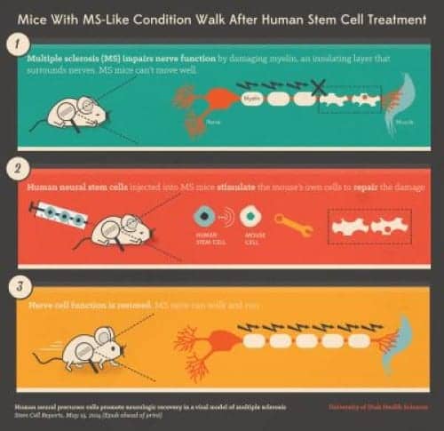 Stem Cell Treatment Improves Ability of Mice with MS-Like Condition to Walk