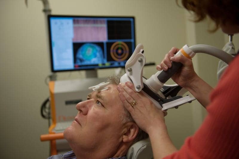 Study to Examine Benefits of Brain Stimulation on Motor Function for Stroke Patients