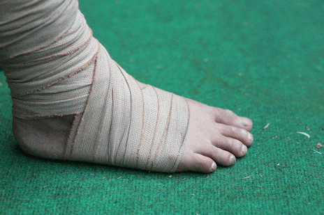 Ankle Sprains Need Physical Therapy, Too