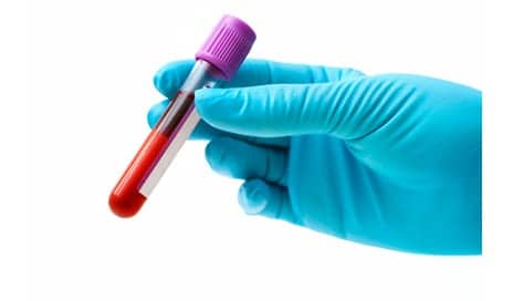 Blood Test May Determine Concussion Evidence Up to 7 Days Postinjury