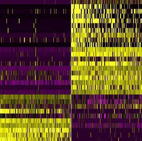 Specific Cells and Genes May Be Potential TBI Treatment Targets