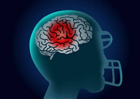 Even Routine Hits Playing Football Could Lead to Brain Injury