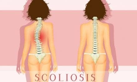 Study Evaluating 3dMD Technology for Scoliosis is Enrolling Participants