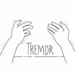 Mayo Clinic, Jogo Health Partner to Study Tremors