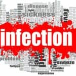 Transcriptomic Technique CIBERSORTx May Help ID Joint Infections