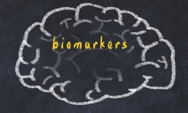 Rune Labs Study to ID Biomarkers of Multiple Sclerosis Lesions