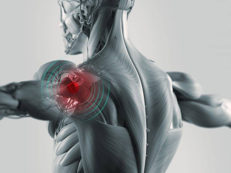 Physical Therapy for Rotator Cuff Impingement: What to Expect