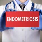 Women with Endometriosis May Have Higher Risk of Stroke