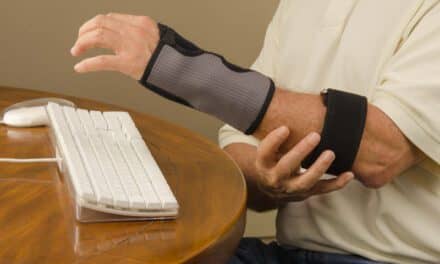 ESStim Technology for Carpal Tunnel Syndrome Advances to Phase II Trial