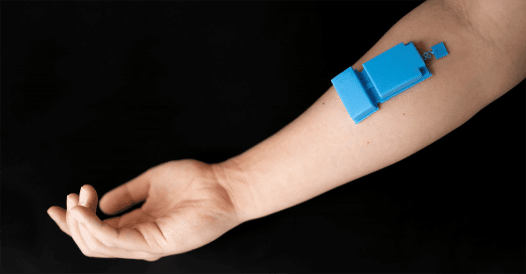 Wearable ultrasound device shown adhered to forearm offers continuous, long-term monitoring of muscle activity.