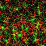 Texas Scientists ID Protein That Heightens Neurodegenerative Disease