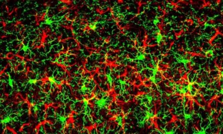 Texas Scientists ID Protein That Heightens Neurodegenerative Disease